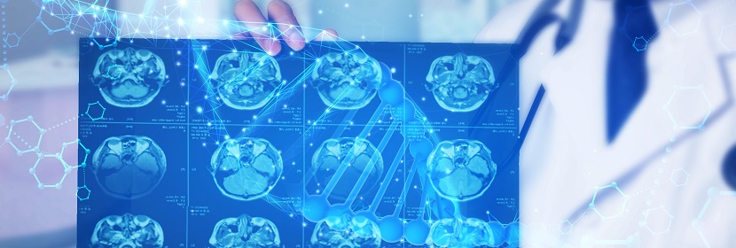 DSA(數(shù)字減影血管造影)放射衛(wèi)生檢測評價