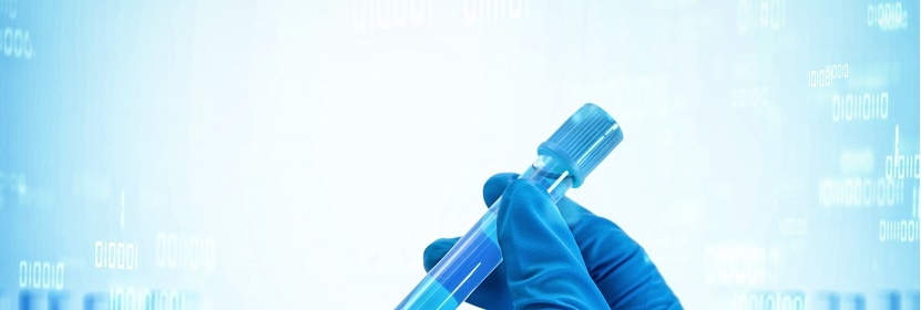 板式熱交換器用橡膠密封墊片檢測(cè)