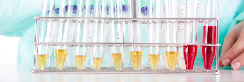 異戊醇(3-甲基-1-丁醇)檢測(cè)